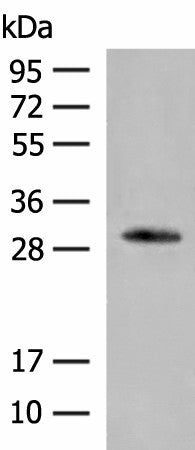 VDAC3 Polyclonal Antibody – Figure 1 of 3