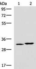 CBR3 Polyclonal Antibody – Figure 1 of 4
