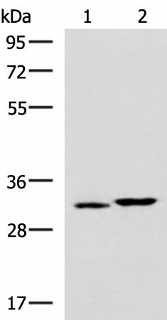 CBR3 Polyclonal Antibody – Figure 1 of 4