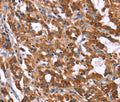 HACE1 Polyclonal Antibody – Figure 1 of 3