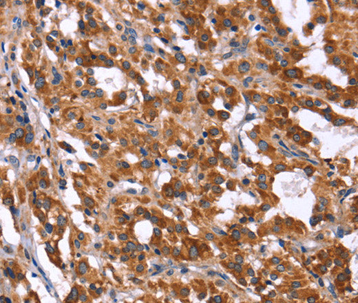 HACE1 Polyclonal Antibody – Figure 1 of 3