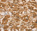 RBBP8 Polyclonal Antibody – Figure 1 of 3