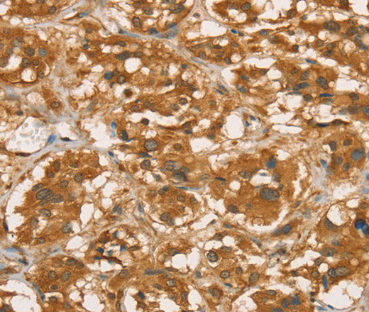 RBBP8 Polyclonal Antibody – Figure 1 of 3