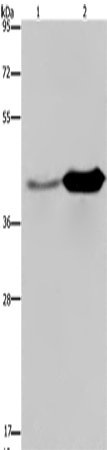 GLUL Polyclonal Antibody – Figure 1 of 4