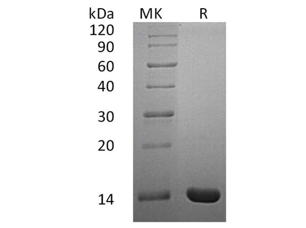 Recombinant Human Interleukin-2/IL-2 Protein (His Tag) – Figure 1 of 2