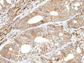 ENPEP Polyclonal Antibody – Figure 1 of 2