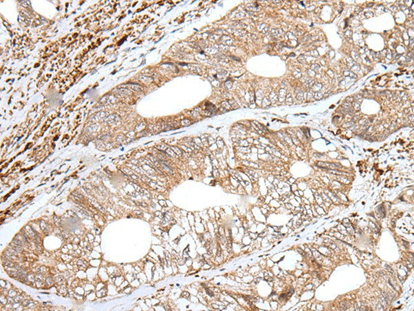 ENPEP Polyclonal Antibody – Figure 1 of 2