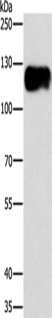 CAST Polyclonal Antibody – Figure 1 of 4