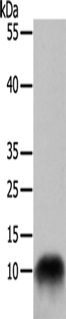 COX7B Polyclonal Antibody – Figure 1 of 3