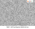 EMT Dual Reporter SW620 Cell Line | Applied Biological Materials (abm)