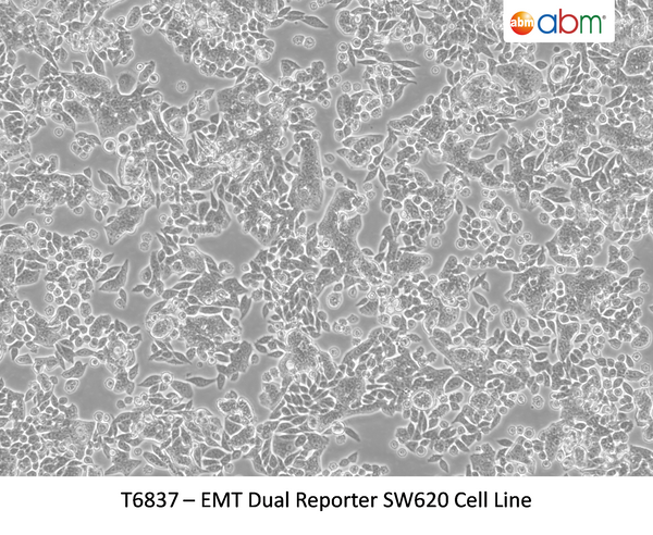 EMT Dual Reporter SW620 Cell Line | Applied Biological Materials (abm)
