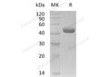 Recombinant Human Netrin-G1/NTNG1 Protein (His Tag) – Figure 1 of 2