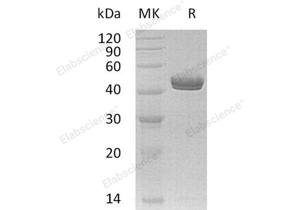 Recombinant Human Netrin-G1/NTNG1 Protein (His Tag) – Figure 1 of 2