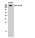 Phospho-IRS1 (Ser636) Polyclonal Antibody – Figure 1 of 2