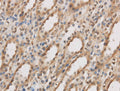 IL10RB Polyclonal Antibody – Figure 1 of 2