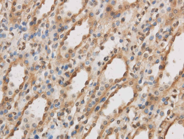 IL10RB Polyclonal Antibody – Figure 1 of 2