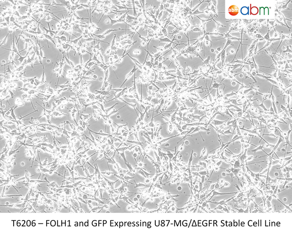 FOLH1 and GFP Expressing U87-MG/ΔEGFR Stable Cell Line | Applied Biological Materials (abm)