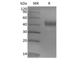 Recombinant Human Tumor-associated Calcium Signal Transducer 2/TROP-2 (248AA, C-6His) – Figure 1 of 2
