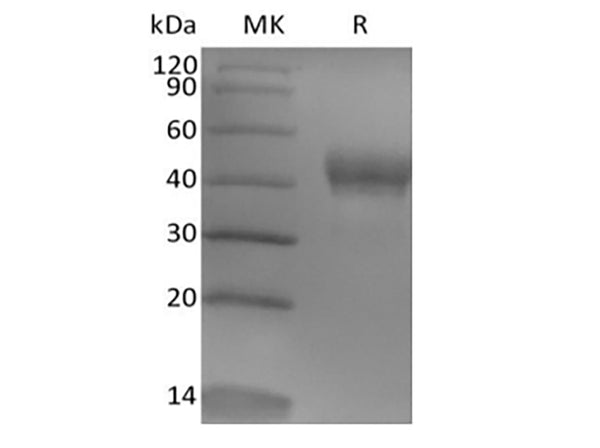 Recombinant Human Tumor-associated Calcium Signal Transducer 2/TROP-2 (248AA, C-6His) – Figure 1 of 2