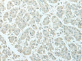 C8orf4 Polyclonal Antibody – Figure 1 of 3