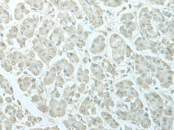C8orf4 Polyclonal Antibody – Figure 1 of 3