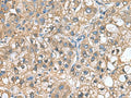 IGLL1 Polyclonal Antibody – Figure 1 of 2