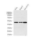 GLUT-3 Polyclonal Antibody – Figure 1 of 4