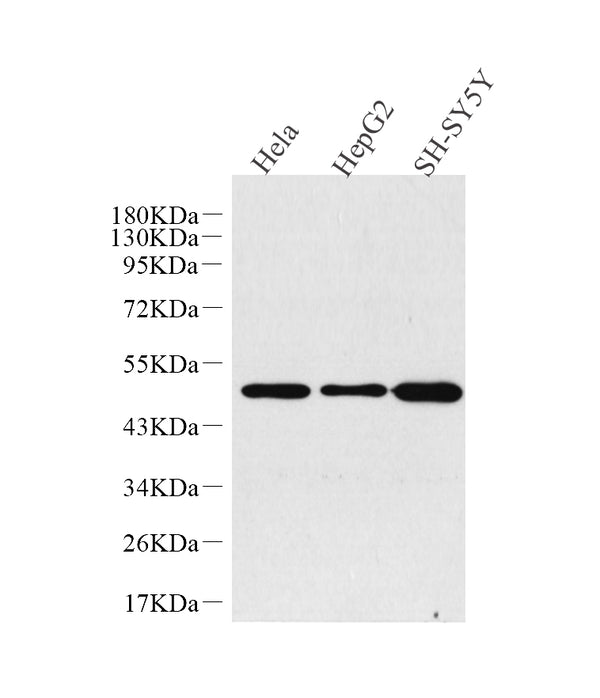 GLUT-3 Polyclonal Antibody – Figure 1 of 4