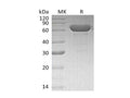 Recombinant Human Serum Albumin/HSA Protein (His Tag) – Figure 1 of 2