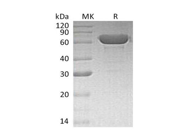 Recombinant Human Serum Albumin/HSA Protein (His Tag) – Figure 1 of 2