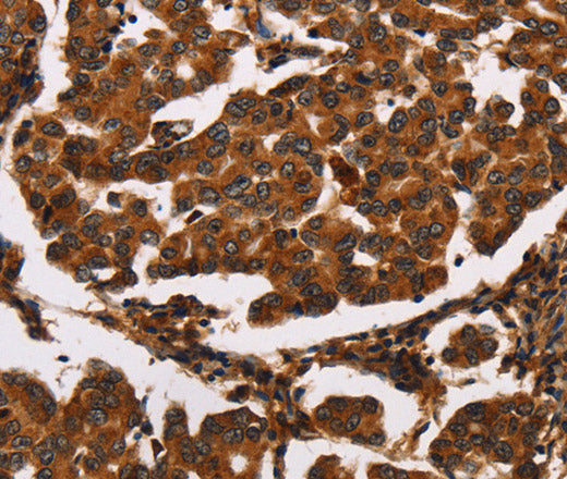 ARSB Polyclonal Antibody – Figure 1 of 3