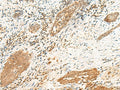 POLR1D Polyclonal Antibody – Figure 1 of 3