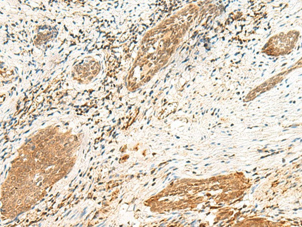 POLR1D Polyclonal Antibody – Figure 1 of 3