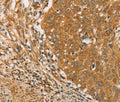 ARMCX3 Polyclonal Antibody – Figure 1 of 3