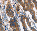 MAD2L1BP Polyclonal Antibody – Figure 1 of 3