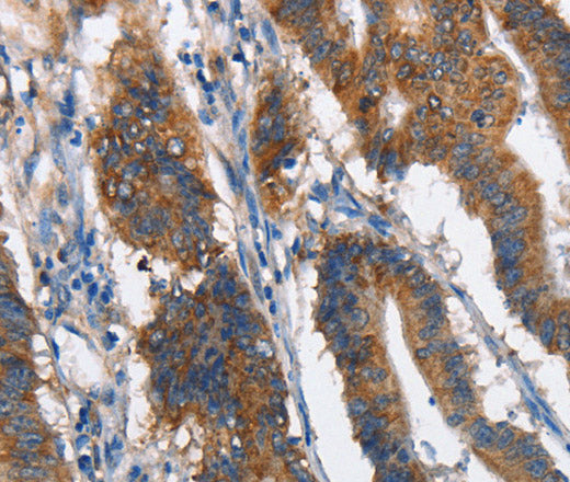 MAD2L1BP Polyclonal Antibody – Figure 1 of 3