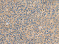 AHNAK Polyclonal Antibody – Figure 1 of 3