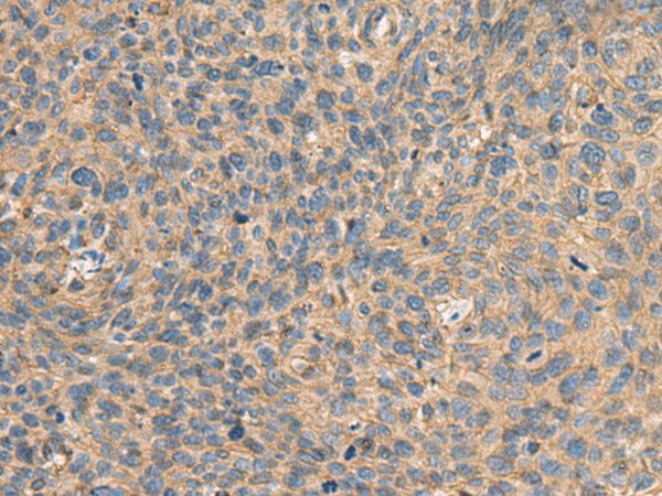 AHNAK Polyclonal Antibody – Figure 1 of 3