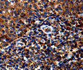 IL13RA1 Polyclonal Antibody – Figure 1 of 3