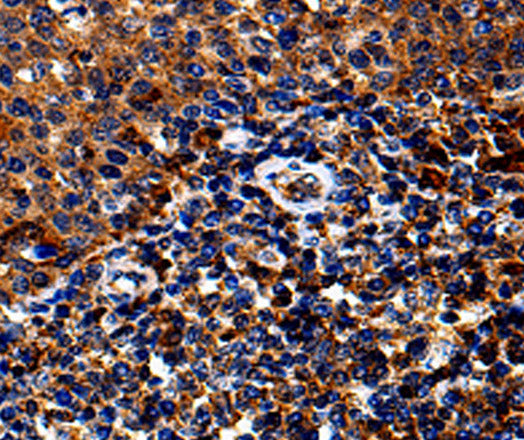 IL13RA1 Polyclonal Antibody – Figure 1 of 3