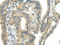 CCL13 Polyclonal Antibody – Figure 1 of 3