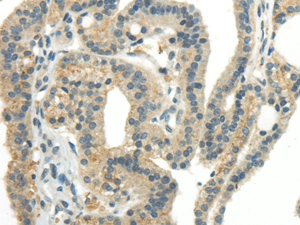 CCL13 Polyclonal Antibody – Figure 1 of 3