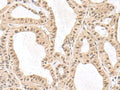 RPS6KA5 Polyclonal Antibody – Figure 1 of 3