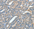 ANGPT1 Polyclonal Antibody – Figure 1 of 3