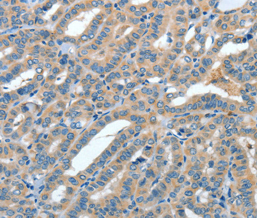 ANGPT1 Polyclonal Antibody – Figure 1 of 3