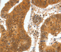 SPDEF Polyclonal Antibody – Figure 1 of 3