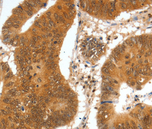 SPDEF Polyclonal Antibody – Figure 1 of 3