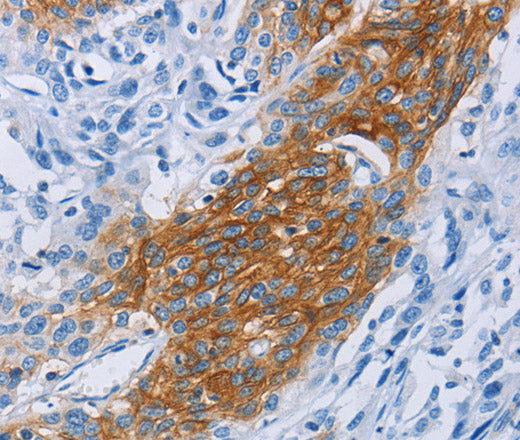 CCR9 Polyclonal Antibody – Figure 1 of 3