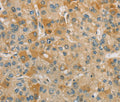 CENPF Polyclonal Antibody – Figure 1 of 3