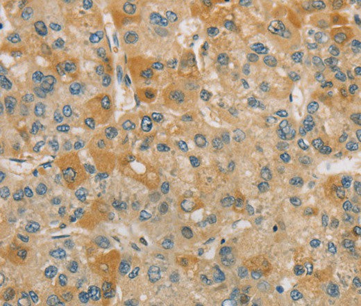 CENPF Polyclonal Antibody – Figure 1 of 3